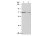 Western Blot analysis of A375 and A431 cell using SH-PTP1 Polyclonal Antibody at dilution of 1:500