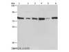 Western Blot analysis of Jurkat, 293T, Hela and K562 cell, Human testis tissue and A549 cell using SIRT1 Polyclonal Antibody at dilution of 1:500