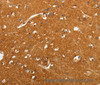 Immunohistochemistry of paraffin-embedded Human brain tissue using SLC4A4 Polyclonal Antibody at dilution 1:50