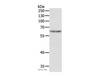 Western Blot analysis of Jurkat cell using TRAF3IP2 Polyclonal Antibody at dilution of 1:500
