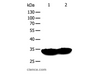 Western Blot analysis of Mouse heart and muscle tissue using TPM1 Polyclonal Antibody at dilution of 1:400