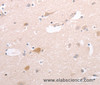 Immunohistochemistry of paraffin-embedded Human brain tissue using CIDEB Polyclonal Antibody at dilution 1:50