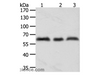 Western Blot analysis of A375, Hela and Jurkat cell using TYR Polyclonal Antibody at dilution of 1:600