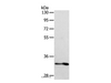Western Blot analysis of Human fetal intestine tissue using ST2 Polyclonal Antibody at dilution of 1:700