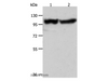 Western Blot analysis of Human fetal muscle tissue and hela cell using ACTN3 Polyclonal Antibody at dilution of 1:400