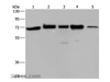 Western Blot analysis of A172, Hela and 293T cell, K562 cell and Human testis tissue using AGFG1 Polyclonal Antibody at dilution of 1:727