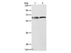 Western Blot analysis of 293T and Jurkat cell using ALAS2 Polyclonal Antibody at dilution of 1:1000