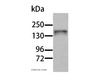 Western Blot analysis of Human liver tissue using AOX1 Polyclonal Antibody at dilution of 1:1000