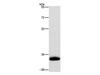 Western Blot analysis of Human testis tissue using AMBP Polyclonal Antibody at dilution of 1:500