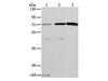 Western Blot analysis of Hela and SKOV3 cell, Mouse liver tissue using ALS2CR11 Polyclonal Antibody at dilution of 1:500