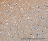 Immunohistochemistry of paraffin-embedded Human brain tissue using AMBRA1 Polyclonal Antibody at dilution 1:50