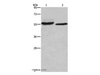 Western Blot analysis of SP20 cell and Mouse heart tissue using AMIGO2 Polyclonal Antibody at dilution of 1:615