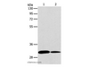 Western Blot analysis of NIH/3T3 and A172 cell using ATG5 Polyclonal Antibody at dilution of 1:475