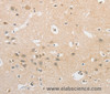 Immunohistochemistry of paraffin-embedded Human brain  tissue using APLF Polyclonal Antibody at dilution 1:40