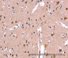Immunohistochemistry of paraffin-embedded Human brain  tissue using ARC Polyclonal Antibody at dilution 1:50