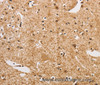 Immunohistochemistry of paraffin-embedded Human brain  using ARHGEF5 Polyclonal Antibody at dilution of 1:50