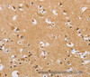 Immunohistochemistry of paraffin-embedded Human brain  tissue using ARHGEF1 Polyclonal Antibody at dilution 1:50