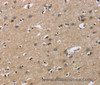 Immunohistochemistry of paraffin-embedded Human brain  tissue using GAB1 Polyclonal Antibody at dilution 1:40