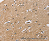 Immunohistochemistry of paraffin-embedded Human brain  tissue using FLT3 Polyclonal Antibody at dilution 1:50