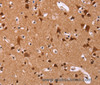 Immunohistochemistry of paraffin-embedded Human brain  tissue using ART5 Polyclonal Antibody at dilution 1:50