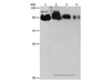 Western Blot analysis of Hela, PC3, 231 and 293T cell using EPS15L1 Polyclonal Antibody at dilution of 1:350