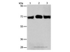 Western Blot analysis of Hela and A549 cell, Human liver cancer tissue using RPN1 Polyclonal Antibody at dilution of 1:350