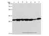 Western Blot analysis of Human placenta tissue and A549 cell, Mouse brain tissue and hepG2 cell, Raji cell and Human fetal liver tissue, hela cell using AK2 Polyclonal Antibody at dilution of 1:300