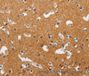 Immunohistochemistry of paraffin-embedded Human brain tissue using HK2 Polyclonal Antibody at dilution 1:40