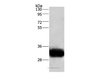 Western Blot analysis of Human fetal brain tissue using GPM6A Polyclonal Antibody at dilution of 1:950