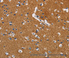Immunohistochemistry of paraffin-embedded Human brain using GPM6A Polyclonal Antibody at dilution of 1:40