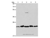 Western Blot analysis of Mouse spleen and Human fetal liver tissue, hela cell and Mouse testis tissue, A431 cell using THOC7 Polyclonal Antibody at dilution of 1:500