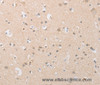 Immunohistochemistry of paraffin-embedded Human brain  tissue using ATG9A Polyclonal Antibody at dilution 1:40