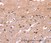 Immunohistochemistry of paraffin-embedded Human brain  tissue using PIP5K1B Polyclonal Antibody at dilution 1:30