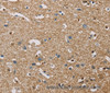 Immunohistochemistry of paraffin-embedded Human brain  using PIP4K2A Polyclonal Antibody at dilution of 1:40