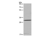 Western Blot analysis of 231 cell using ASGR1 Polyclonal Antibody at dilution of 1:300