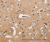 Immunohistochemistry of paraffin-embedded Human brain tissue using ATP2C1 Polyclonal Antibody at dilution 1:50