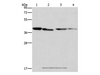 Western Blot analysis of Human placenta tissue and NIH/3T3 cell, Raji and hepG2 cell using BCAT2 Polyclonal Antibody at dilution of 1:312.5