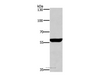 Western Blot analysis of Mouse brain tissue using PPP3CA Polyclonal Antibody at dilution of 1:650