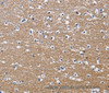 Immunohistochemistry of paraffin-embedded Human brain  using PPP3CA Polyclonal Antibody at dilution of 1:30