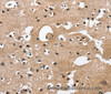 Immunohistochemistry of paraffin-embedded Human brain  tissue using CAMK1D Polyclonal Antibody at dilution 1:50