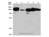 Western Blot analysis of Hela cell and Mouse liver tissue, 231 cell and Human placenta tissue, Human carcinoma of sigmoid tissue using CANX Polyclonal Antibody at dilution of 1:420