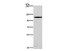 Western Blot analysis of Human fetal brain tissue using CARD14 Polyclonal Antibody at dilution of 1:650