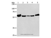 Western Blot analysis of Mouse liver tissue and Raji cell, hela, hepG2 and A549 cell using CAT Polyclonal Antibody at dilution of 1:266.6