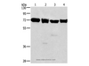 Western Blot analysis of 231, 293T, Raji and hela cell using IL2RB Polyclonal Antibody at dilution of 1:325