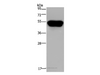Western Blot analysis of Hela cell using CD160 Polyclonal Antibody at dilution of 1:250