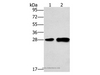 Western Blot analysis of Mouse liver tissue and 231 cell using LY96 Polyclonal Antibody at dilution of 1:500