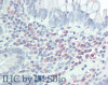 Immunohistochemistry of paraffin-embedded Small Intestine tissue using CD272 Polyclonal Antibody at dilution of 1:50 (Elabscience® Product Detected by Lifespan).