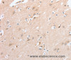 Immunohistochemistry of paraffin-embedded Human brain  tissue using SIGLEC9 Polyclonal Antibody at dilution 1:40