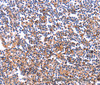 Immunohistochemistry of paraffin-embedded Human tonsil tissue using COL20A1 Polyclonal Antibody at dilution 1:40