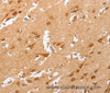 Immunohistochemistry of paraffin-embedded Human brain  using cPLA2 Polyclonal Antibody at dilution of 1:50